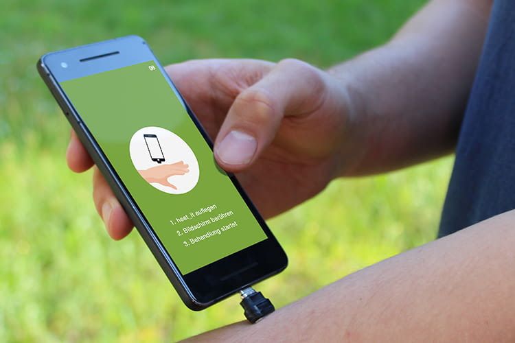 Das heat_it Smartphone Add-on hilft sofort gegen Mückenstiche