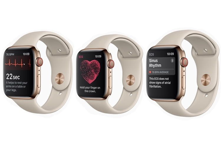 Mit Apple Watch 4 EKG am Handgelenk messen und erfahren, ob die Herzrhythmus-Werte ok sind