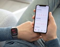 Mittlerweile lässt sich ein EKG häufig direkt mit der Smartwatch durchführen